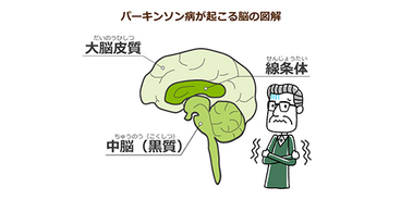 アンケート 高齢者の体の震えが止まらないときの対応は しばらく様子を見てから病院へ が第１位 放置しないで早めの受診が大切です みんなの介護