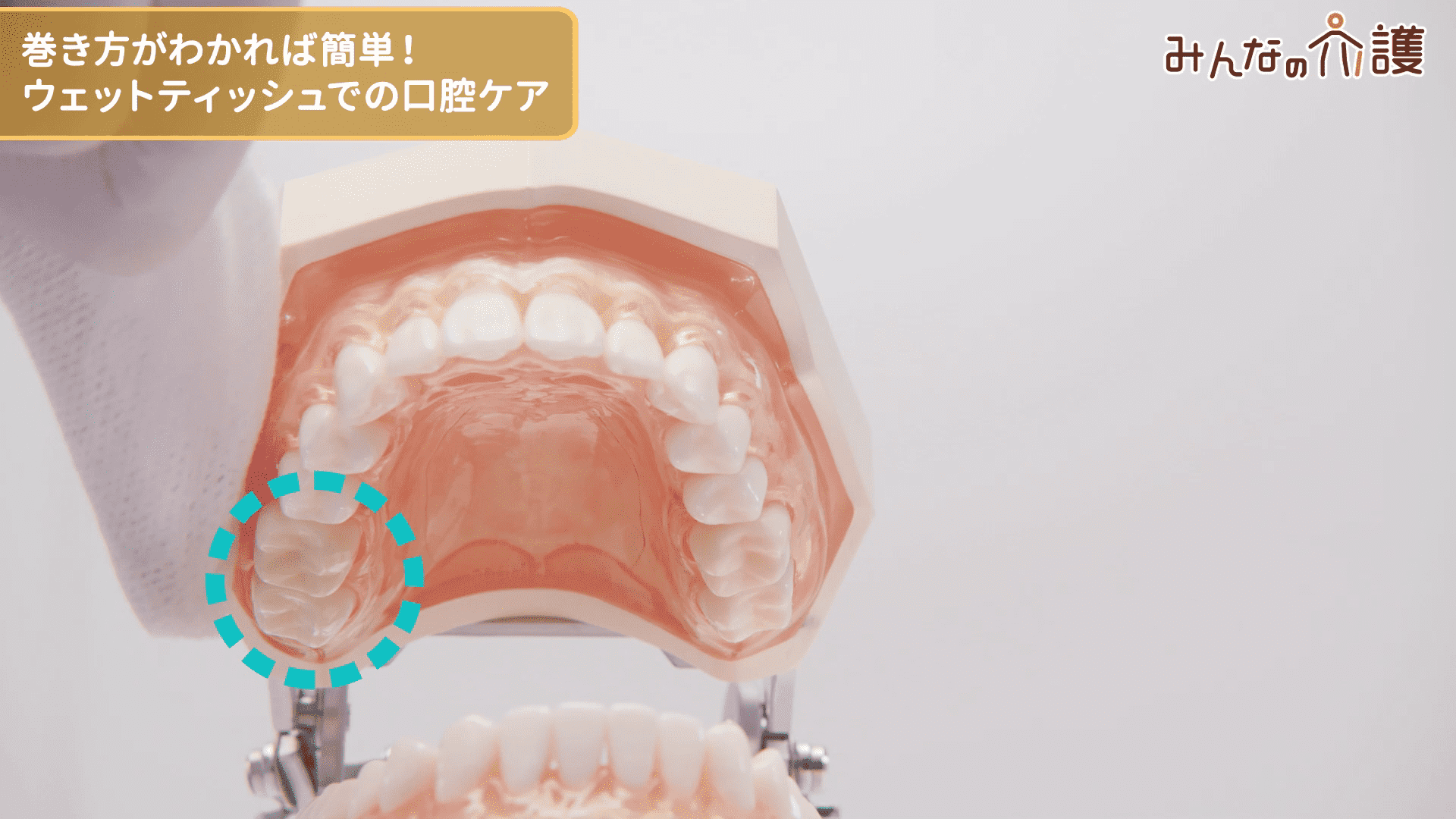 上の歯ぐきを拭く様子