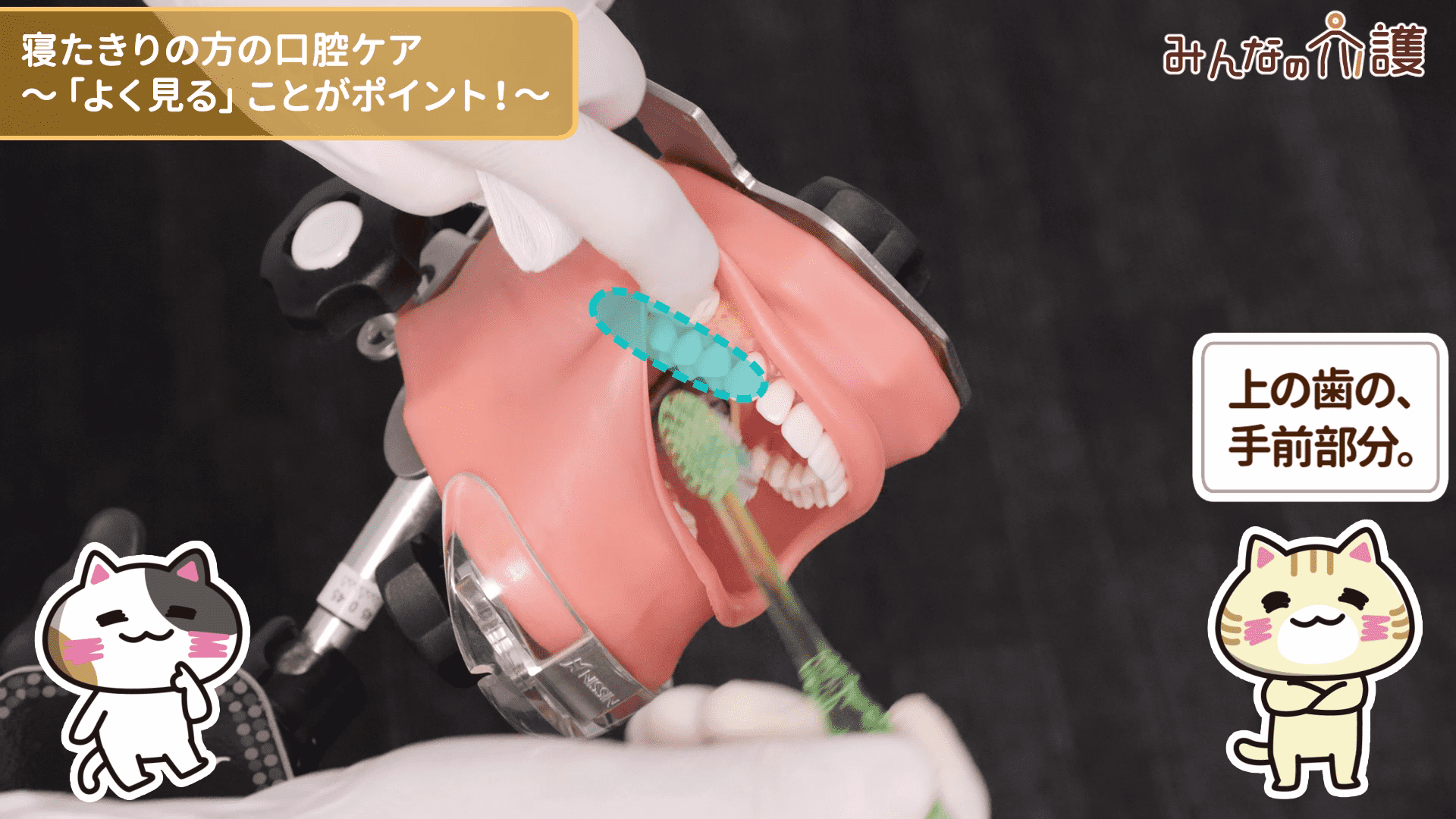 上の歯の、手前部分を磨いている様子