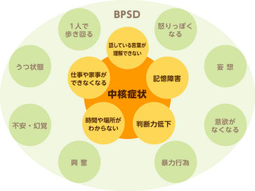 Q A 認知症はどのように進行していくのですか みんなの介護