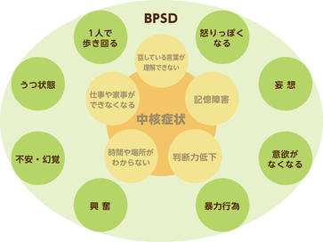 Q A 認知症はどのように進行していくのですか みんなの介護