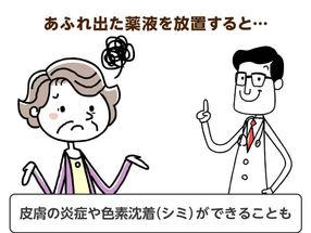 目薬が皮膚の炎症やシミの原因に 薬剤師が教える正しい点眼の方法 介護の教科書 みんなの介護